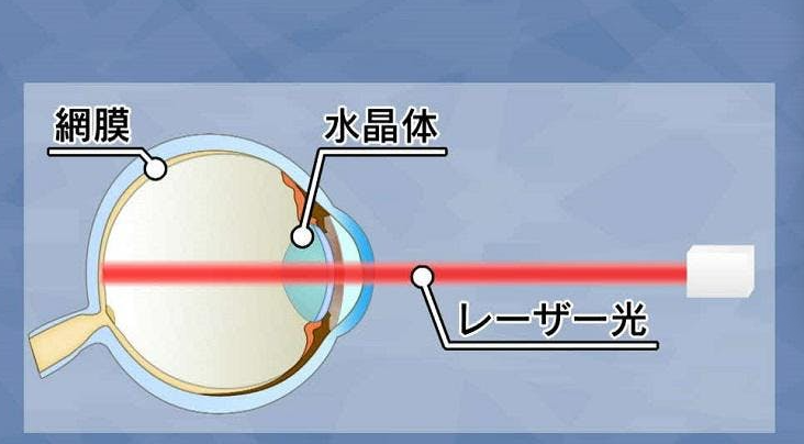 富士通研发的激光视网膜投影视觉扩张技术，发根清晰可见。