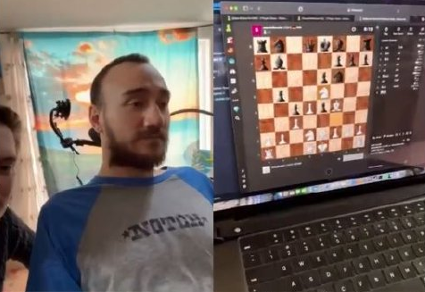 第一位植入马斯克脑机接口的患者发声：植入一年后没有出现副作用
